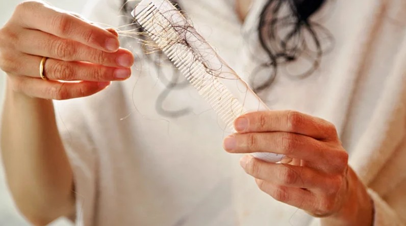 5 Things You Should Know About Hair Loss Treatments