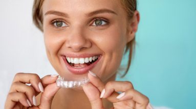 5 Benefits of Invisalign That You Should Know About