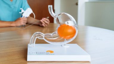 Orbera Gastric Balloon